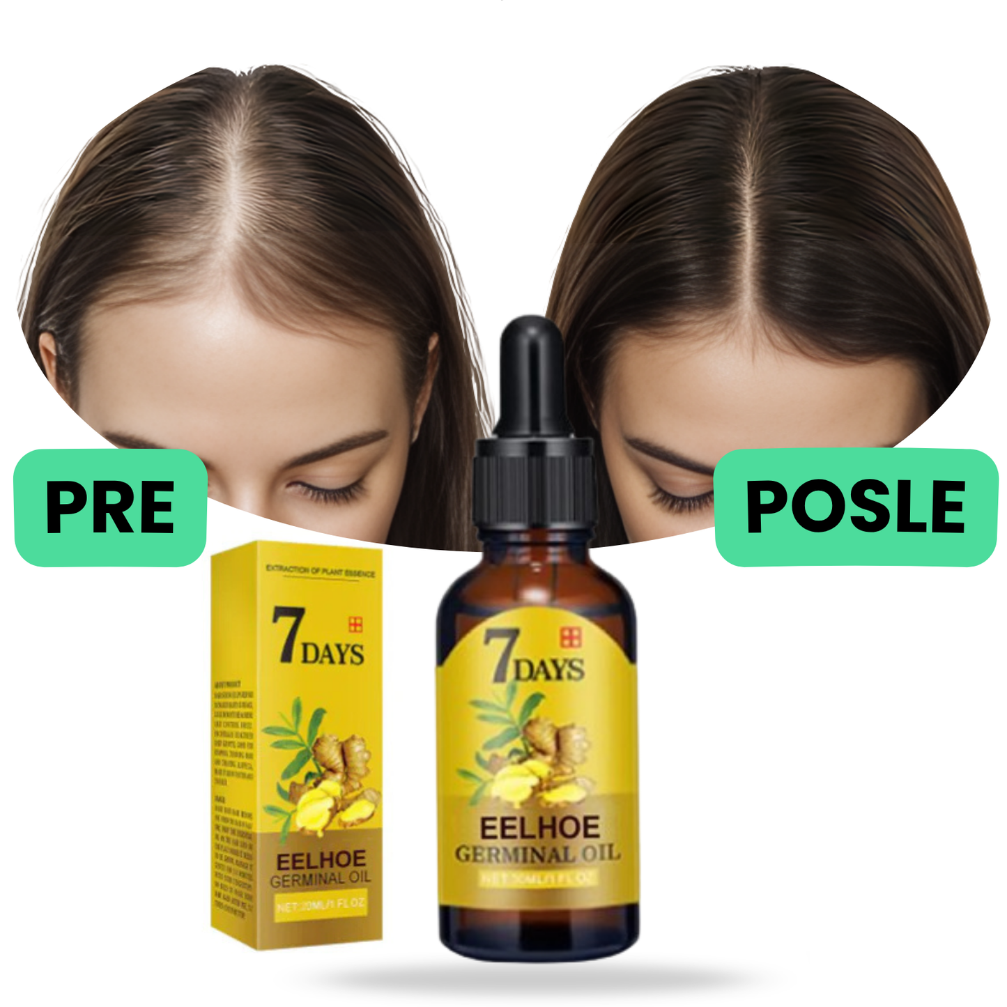 SERUM ZA RAST I GUSTINU KOSE