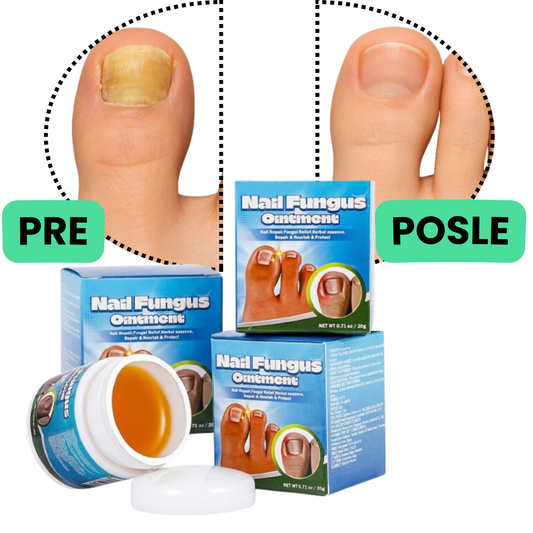 MAST ZA GLJIVICE, ZADEBLJALE I URASLE NOKTE